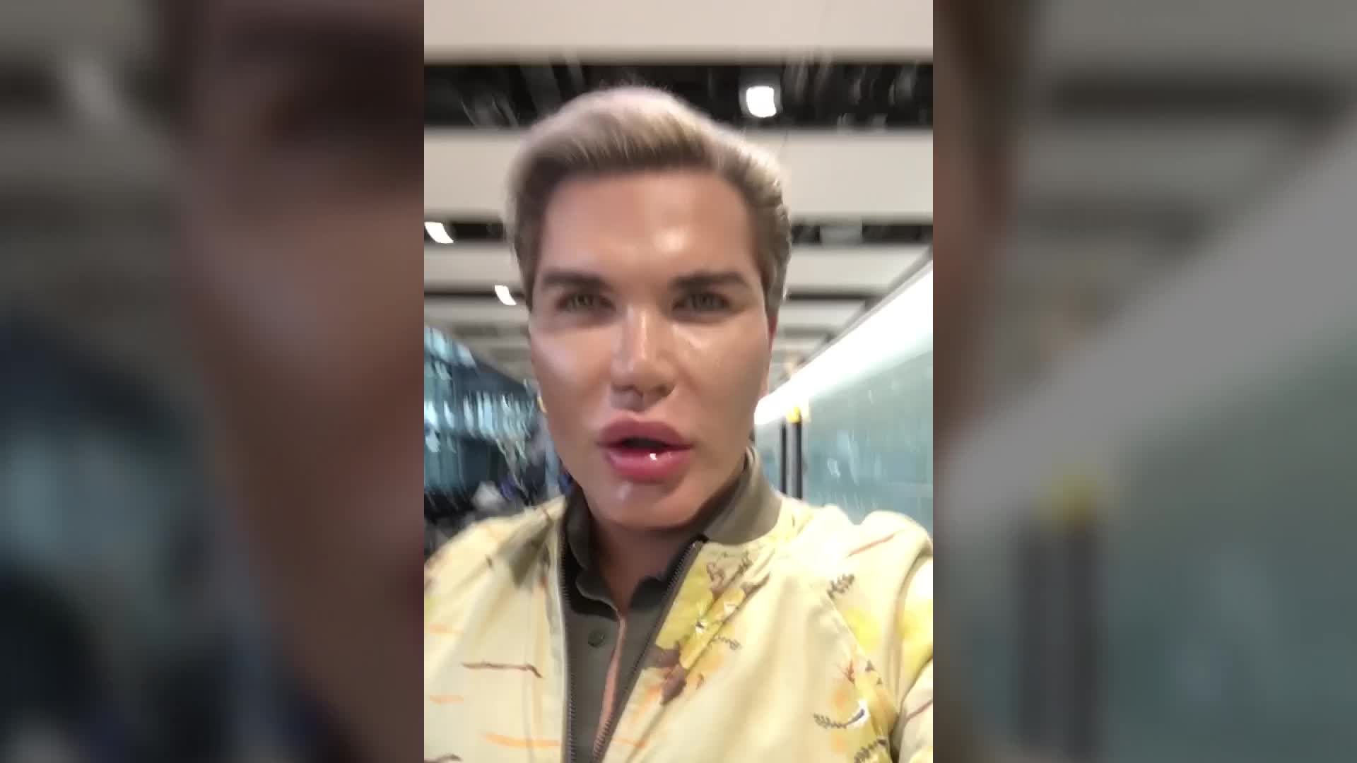 Ken Doll Man Plastic Surgery